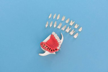 Diş implantı ve taç yerleştirme işlemi parçaları mavi arka planda izole edilmiş. Tıbben doğru 3D model. hI Kalifiye 3D Kopyalama Aralığı Modeli. 