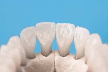 Üst insan çenesi ve mavi arka planda izole edilmiş diş anatomisi modeli. Sağlıklı dişler, diş bakımı ve ortodontik tıbbi konsept. Merhaba kaliteli fotoğraf.