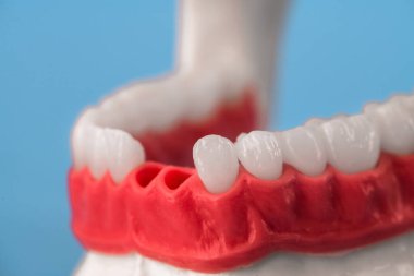 Diş implantı ve taç yerleştirme işlemi parçaları mavi arka planda izole edilmiş. Tıbben doğru 3D model. hI Kalifiye 3D Kopyalama Aralığı Modeli. 