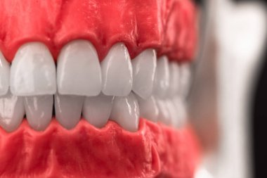 Dişleri ve diş etleri olan insan çenesi. Siyah arka planda izole edilmiş anatomi modeli. Sağlıklı dişler, diş bakımı ve ortodontik sağlık konsepti. Yüksek kalite kopya alanı fotoğrafı. 