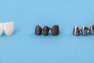 Diş implantı ve taç yerleştirme işlemi parçaları mavi arka planda izole edilmiş. Tıbben doğru 3D model. Merhaba kaliteli fotokopi alanı fotoğrafı. 