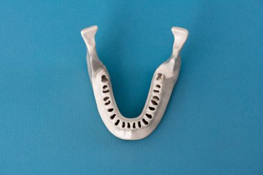 Diş modelsiz üst insan çenesi mavi arka planda izole edilmiş tıbbi implant. Sağlıklı dişler, diş bakımı ve ortodontik konsept. Merhaba kaliteli kopyalama alanı.