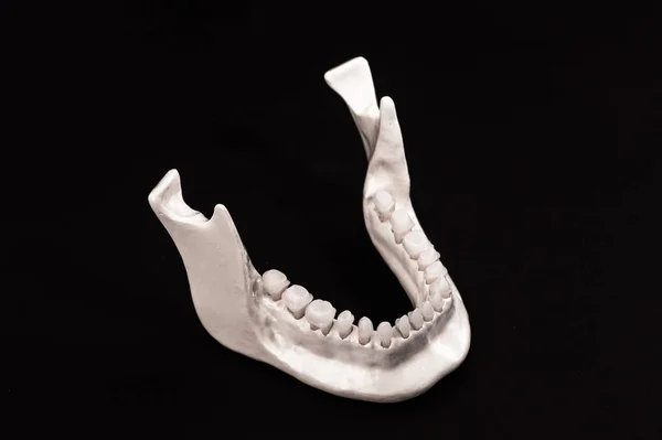 Onderste Menselijke Kaak Met Tanden Anatomie Model Geïsoleerd Zwarte Achtergrond — Stockfoto