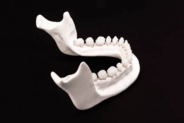 Dolna Szczęka Ludzka Modelem Anatomii Zębów Odizolowanym Czarnym Tle Zdrowe — Zdjęcie stockowe
