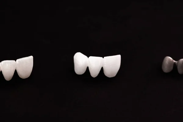 Teeth Implant Crown Installation Process Parts Isolated Black Background Medically — Stock Photo, Image