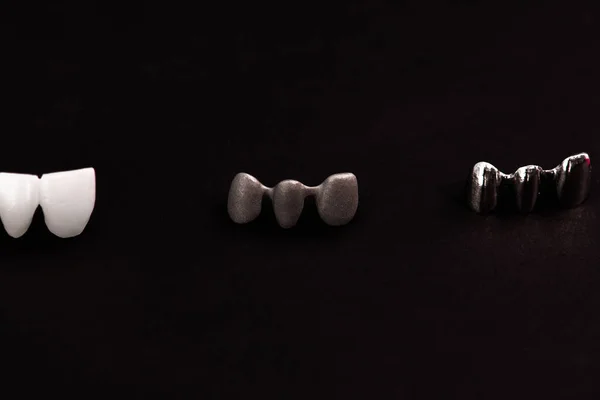 Piezas Del Proceso Instalación Del Implante Dental Corona Aisladas Sobre — Foto de Stock