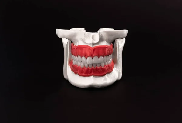 Mandíbula Humana Com Dentes Gengivas Modelo Anatomia Isolado Fundo Preto — Fotografia de Stock