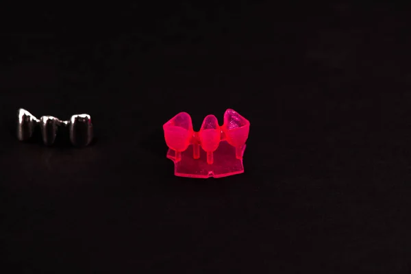 歯のインプラントとクラウンの設置プロセス部品は黒い背景に隔離されています 医学的に正確な3Dモデル 高品質のコピースペースの写真 — ストック写真
