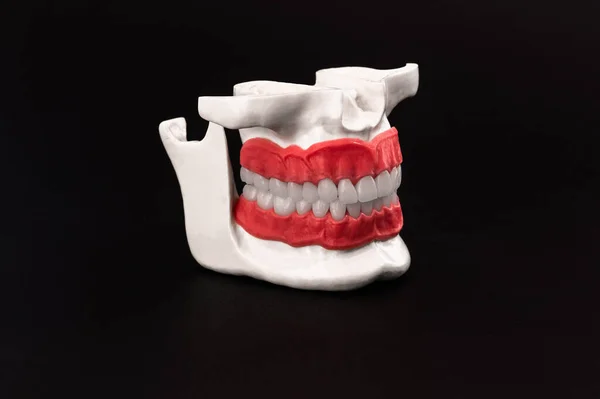 Mandíbula Humana Com Dentes Gengivas Modelo Anatomia Isolado Fundo Preto — Fotografia de Stock