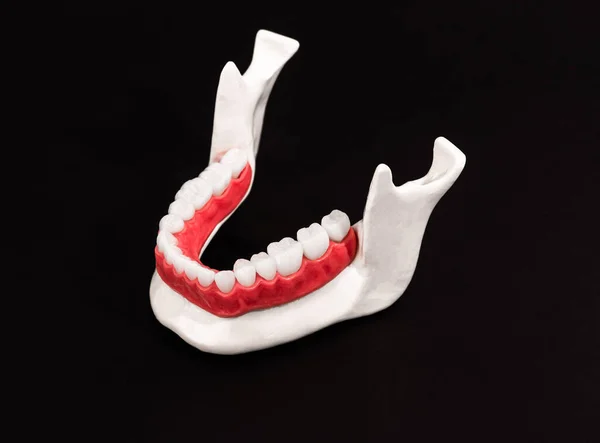 下颌骨 牙齿和牙龈解剖模型 隔离在蓝色背景 健康的牙齿 牙齿护理和牙齿矫正医疗概念 高质复制空间模型照片 — 图库照片