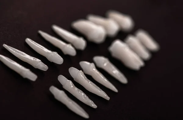歯医者黒の背景に白い歯口腔歯科衛生歯科衛生コンセプト口腔ケア歯の復元トップビュー 高品質のコピースペースの写真 — ストック写真