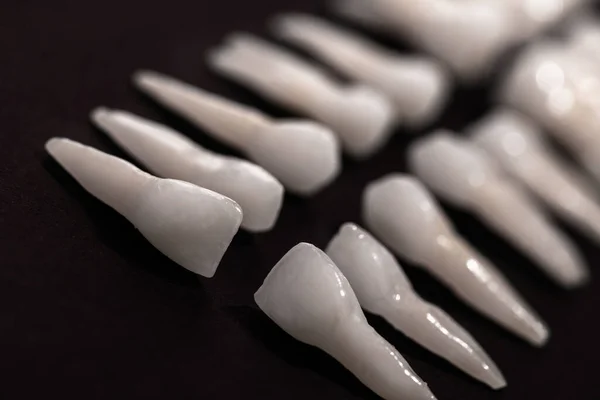 Odontologia Protética Dentes Brancos Sobre Fundo Preto Higiene Dental Oral — Fotografia de Stock