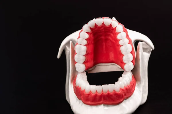 Menselijke Kaak Met Tanden Tandvlees Anatomie Model Geïsoleerd Zwarte Achtergrond — Stockfoto