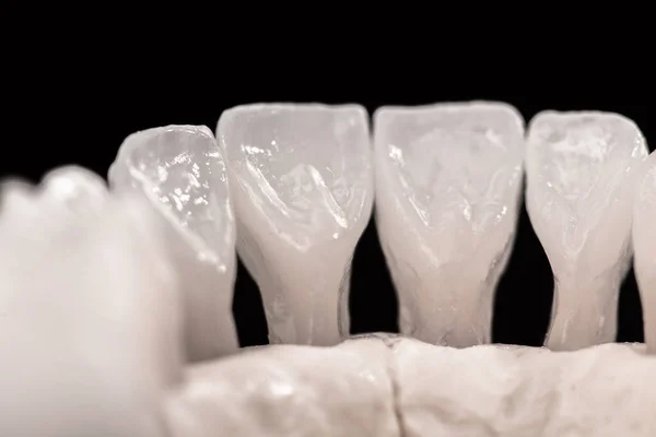 Unterkiefer Mit Zähnen Anatomie Modell Isoliert Auf Schwarzem Hintergrund Gesunde — Stockfoto