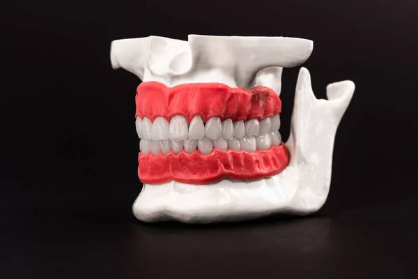 有牙齿和牙龈的人的下颚解剖模型被隔离在黑色背景上 健康的牙齿 牙齿护理和牙齿矫正医疗概念 高质量的复制空间照片 — 图库照片