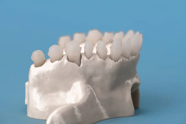 Верхняя Челюсть Человека Моделью Анатомии Зубов Изолирована Синем Фоне Здоровые — стоковое фото
