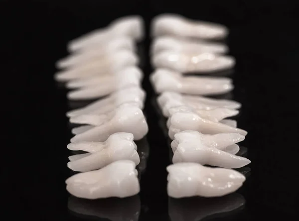 Odontologia Protética Dentes Brancos Sobre Fundo Preto Higiene Dental Oral — Fotografia de Stock