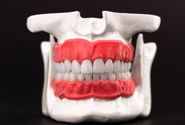 Human jaw with teeth and gums anatomy model isolated on black background. Healthy teeth, dental care and orthodontic medical healthcare concept. Hi-quality copy space photo.