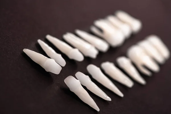 Dentisterie Prothétique Dents Blanches Sur Fond Noir Hygiène Buccodentaire Concept — Photo