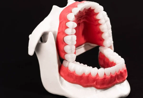 Ludzka Szczęka Zębami Dziąsłami Model Anatomiczny Izolowany Czarnym Tle Otwarta — Zdjęcie stockowe