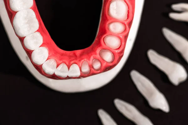 Piezas Del Proceso Instalación Del Implante Dental Corona Aisladas Sobre — Foto de Stock