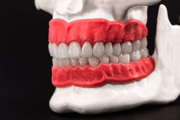 Ludzka Szczęka Zębami Dziąsłami Model Anatomiczny Izolowany Czarnym Tle Zdrowe — Zdjęcie stockowe