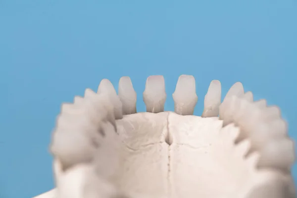 Mandíbula Humana Superior Con Modelo Anatomía Dental Aislado Sobre Fondo — Foto de Stock