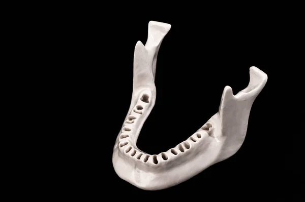 Övermänsklig Käke Utan Tänder Modell Medicinsk Implantat Isolerad Svart Bakgrund — Stockfoto