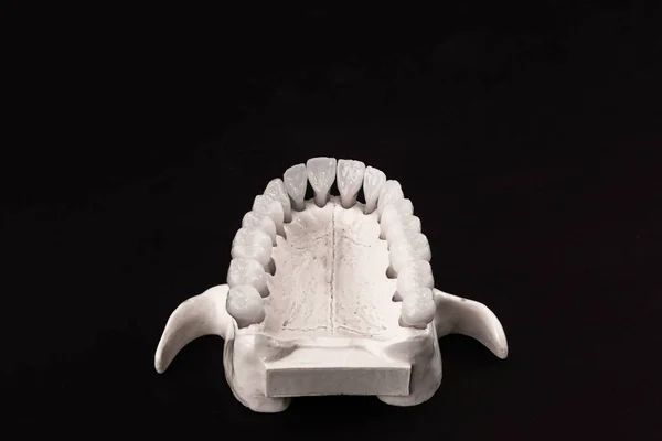 Lower human jaw with teeth anatomy model isolated on black background. Healthy teeth, dental care and orthodontic medical concept. Hi quality photo