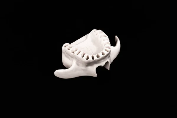 Horní Lidská Čelist Bez Zubů Model Lékařského Implantátu Izolované Černém — Stock fotografie