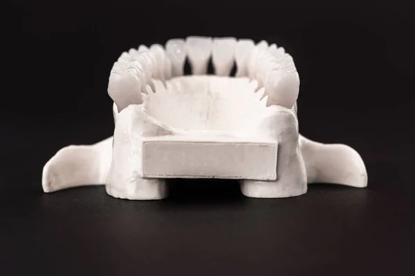 Mandíbula Humana Inferior Com Modelo Anatomia Dos Dentes Isolado Fundo — Fotografia de Stock