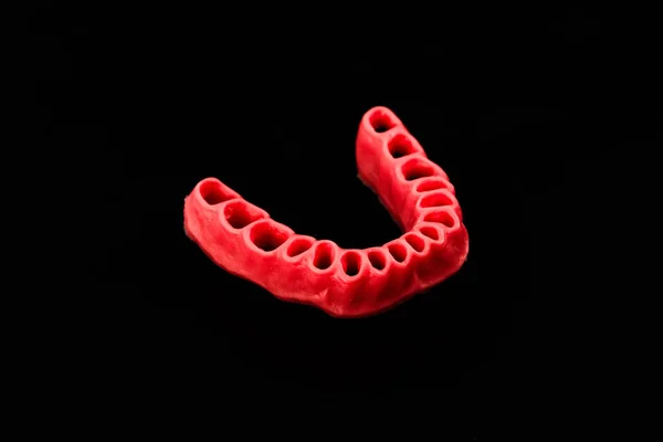 Lidské Dásně Bez Zubů Model Lékařské Implantáty Izolované Černém Pozadí — Stock fotografie