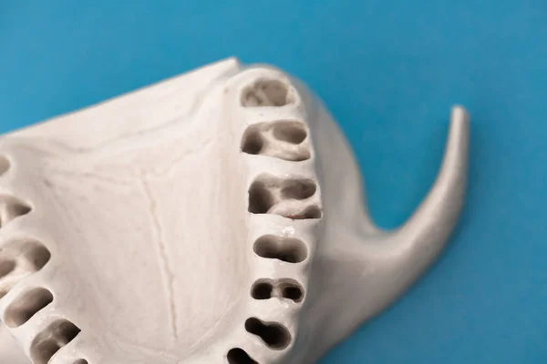 Maxila Humana Superior Sem Dentes Modelo Implante Médico Isolado Fundo — Fotografia de Stock