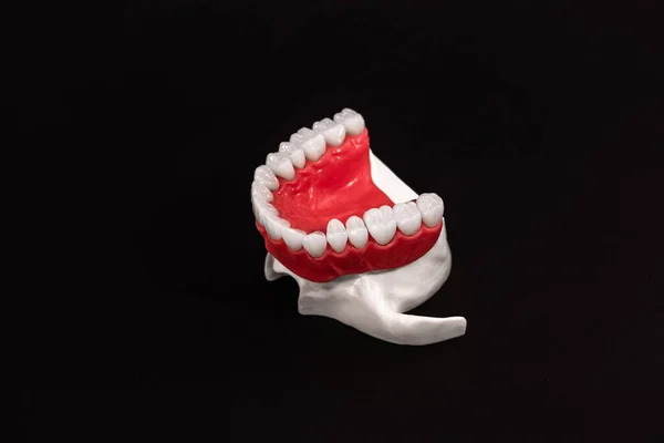 下颌骨与牙齿解剖模型隔离在黑色背景 健康的牙齿 牙齿护理和牙齿矫正医学概念 高质照片 — 图库照片