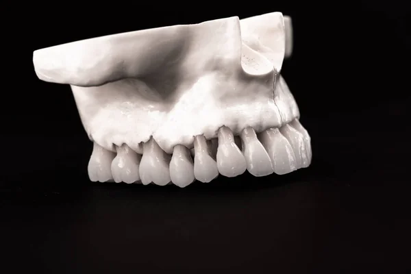 Mandíbula Humana Inferior Con Modelo Anatomía Dental Aislado Sobre Fondo —  Fotos de Stock