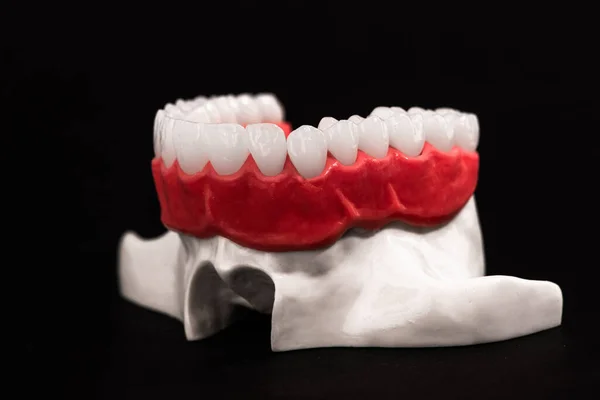 Нижняя Челюсть Человека Анатомической Моделью Зубов Изолирована Черном Фоне Здоровые — стоковое фото