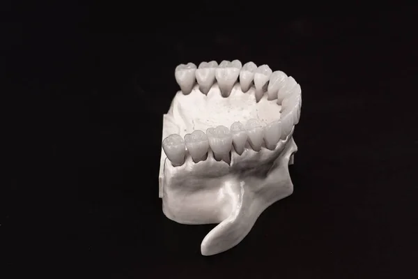 Onderste Menselijke Kaak Met Tanden Anatomie Model Geïsoleerd Zwarte Achtergrond — Stockfoto