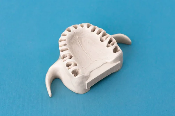 Övre Mänsklig Käke Utan Tänder Modell Medicinsk Implantat Isolerad Blå — Stockfoto