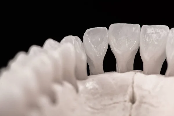 Κάτω Ανθρώπινο Σαγόνι Δόντια Μοντέλο Ανατομίας Απομονώνονται Μαύρο Φόντο Υγιή — Φωτογραφία Αρχείου