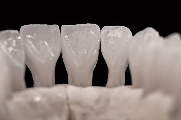 Mandíbula Humana Inferior Com Modelo Anatomia Dos Dentes Isolado Fundo — Fotografia de Stock