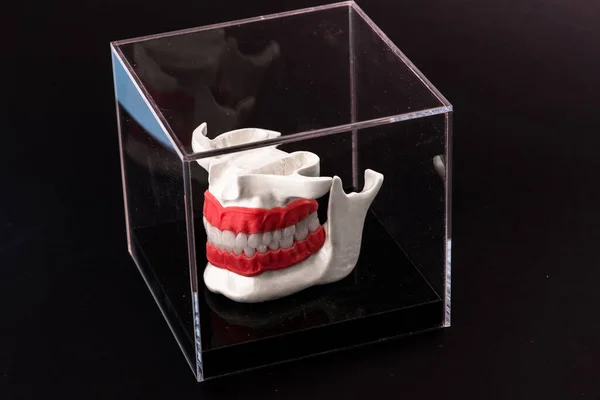 Mandíbula Humana Com Dentes Implantes Modelo Anatomia Isolado Fundo Preto — Fotografia de Stock