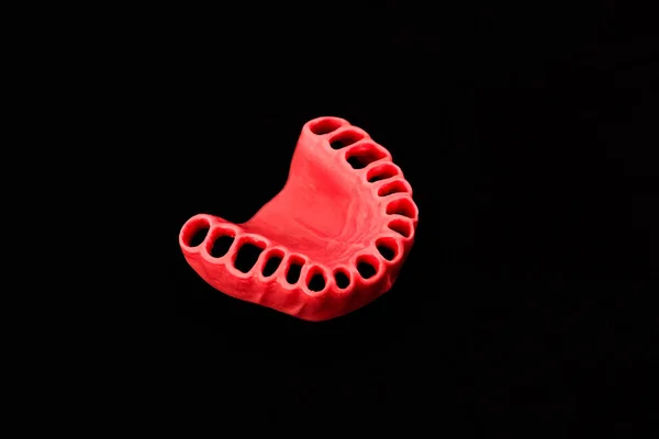 歯のない人間の歯茎は黒い背景に隔離された医療用インプラントをモデル化します 健康な歯 歯のケアと歯列矯正の概念 高品質のコピースペース — ストック写真