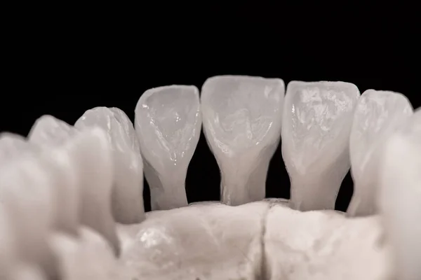 Lägre Mänsklig Käke Med Tänder Anatomi Modell Isolerad Svart Bakgrund — Stockfoto
