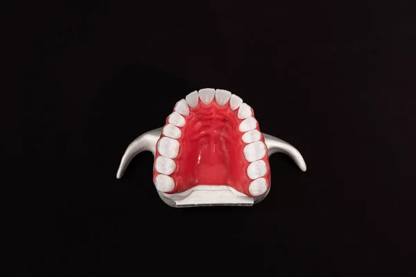 Нижня Щелепа Людини Моделлю Анатомії Зубів Ізольована Чорному Тлі Здорові — стокове фото