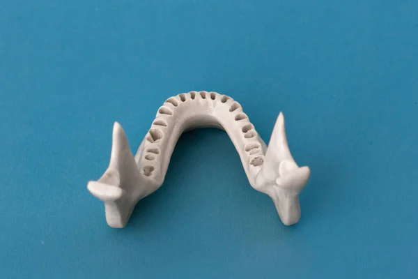 Upper Human Jaw Teeth Model Medical Implant Isolated Blue Background — Stock Photo, Image