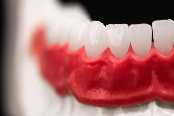 Dolna Szczęka Ludzka Zębami Dziąsłami Model Anatomiczny Izolowany Niebieskim Tle — Zdjęcie stockowe