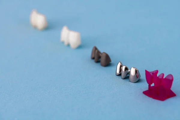 Dentes Implante Coroa Peças Processo Instalação Isolado Fundo Azul Modelo — Fotografia de Stock