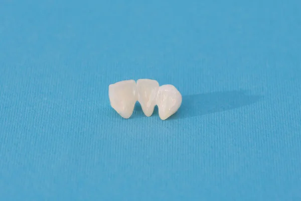 Dents Céramique Sans Métal Implant Couronnes Dentaires Isolées Sur Fond — Photo