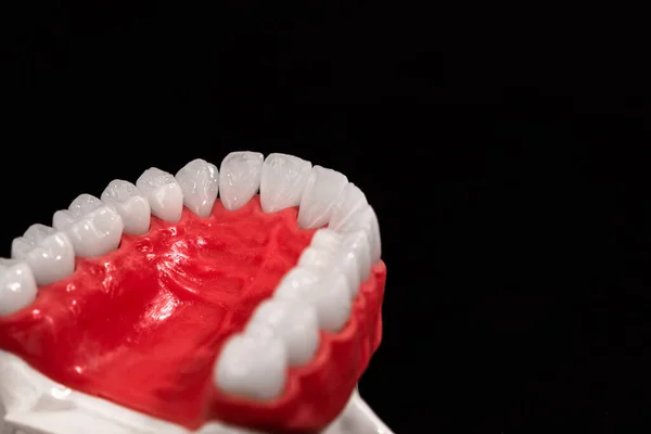 Mandíbula Humana Inferior Com Modelo Anatomia Dos Dentes Isolado Fundo — Fotografia de Stock