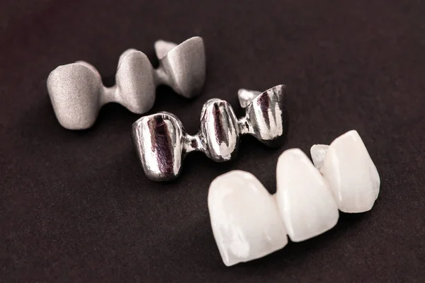 Teeth Implant Crown Installation Process Parts Isolated Black Background Medically — Stock Photo, Image